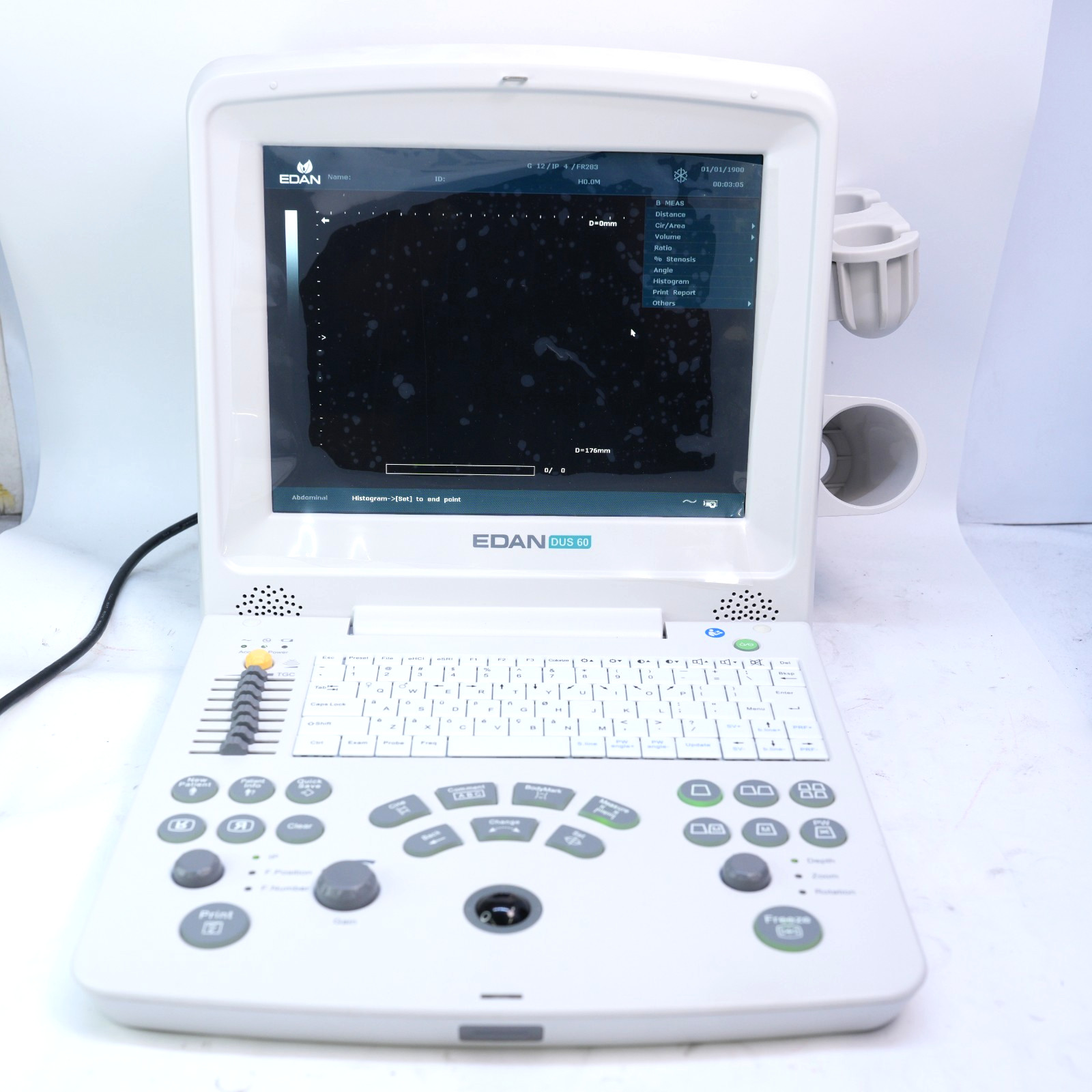 EDAN DUS 60 Digital Portable Ultrasound Diagnostic System *PARTS* T12-D8